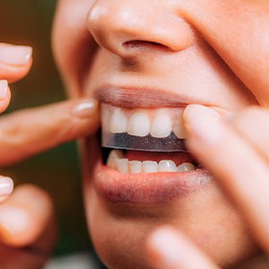 Woman using a whitening strip