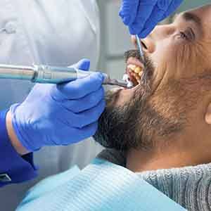 a man having his teeth professionally cleaned